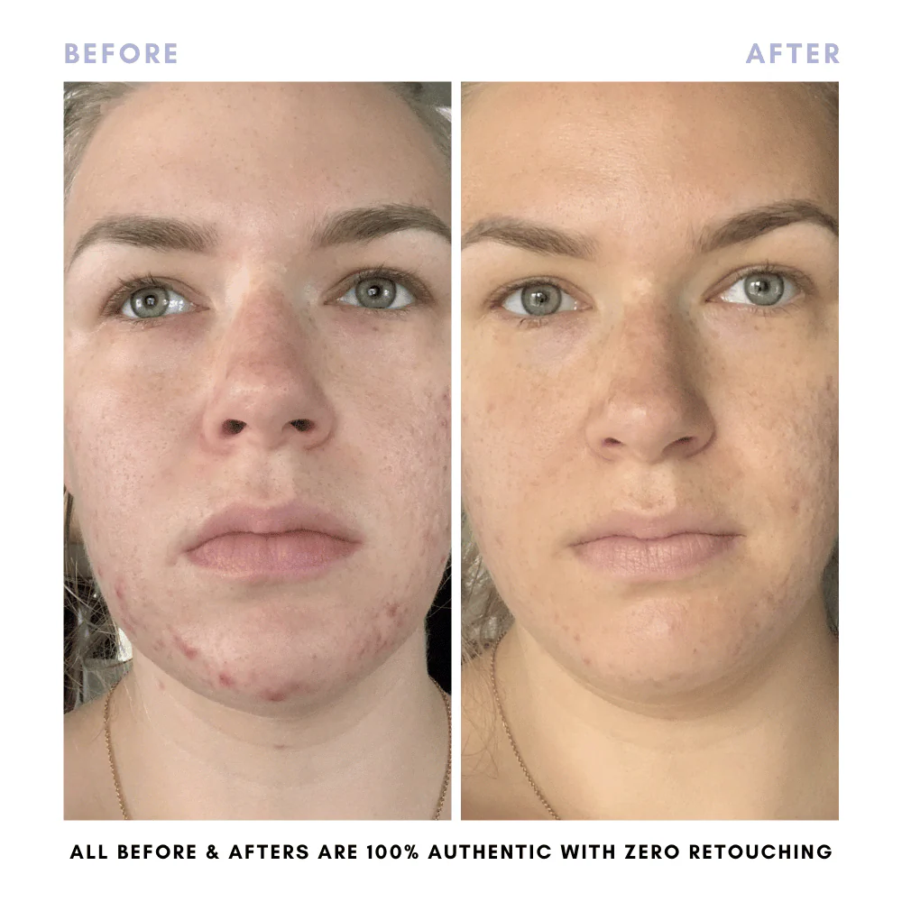 Balancing Oil - Image 9