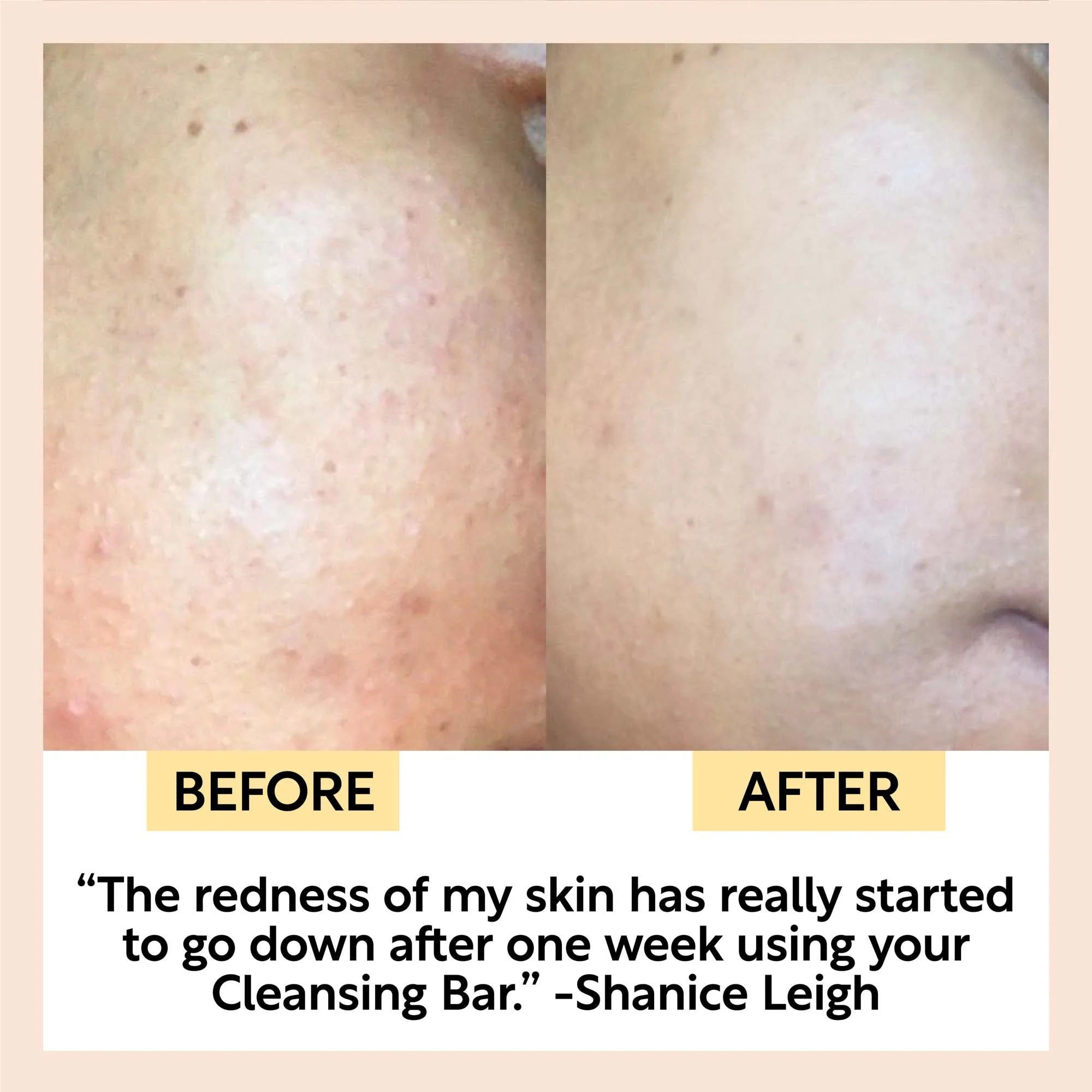 Chai Soap Cleansing Duo - Image 9