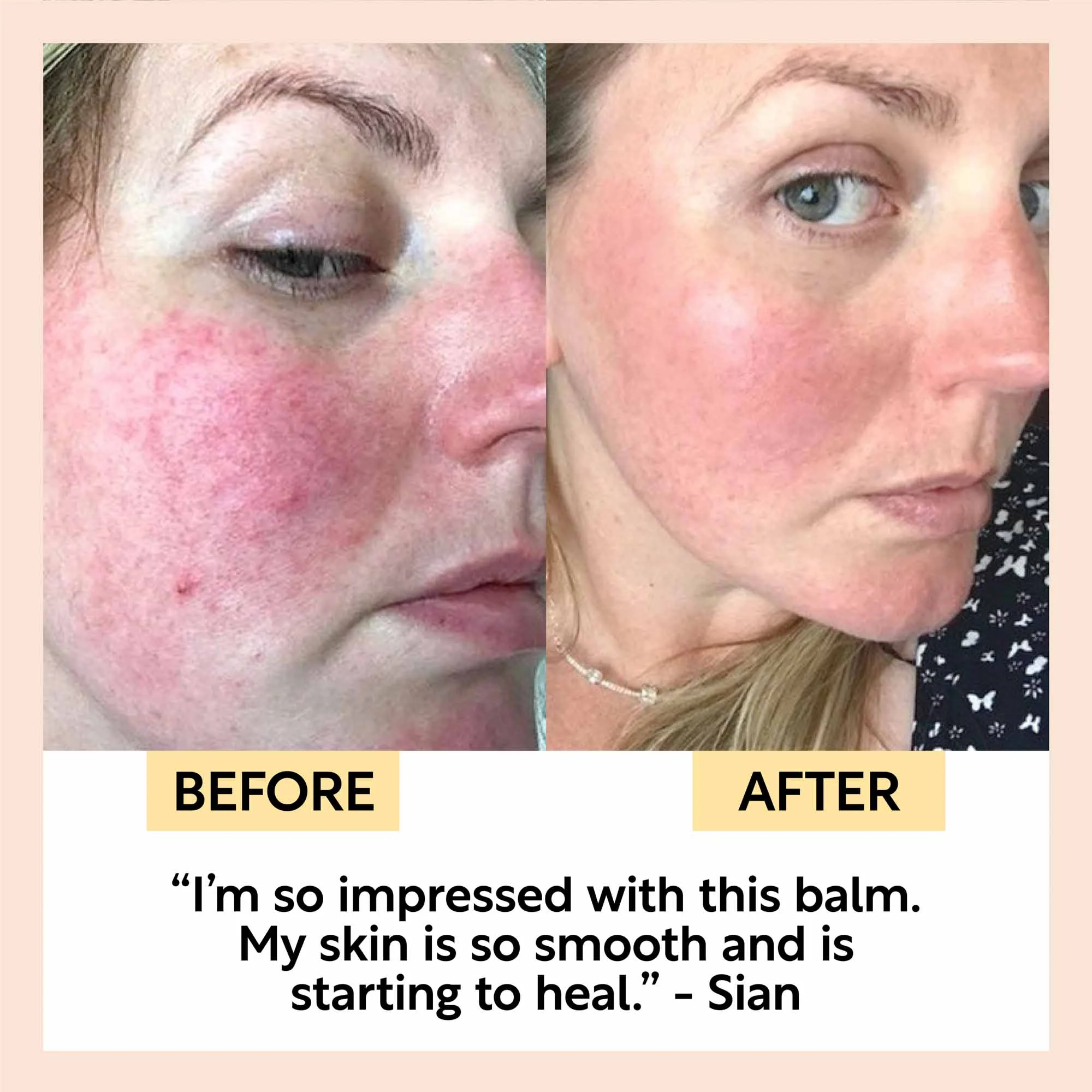 Cleansing Face Balm with Oat Oil + Vitamin E - Image 9