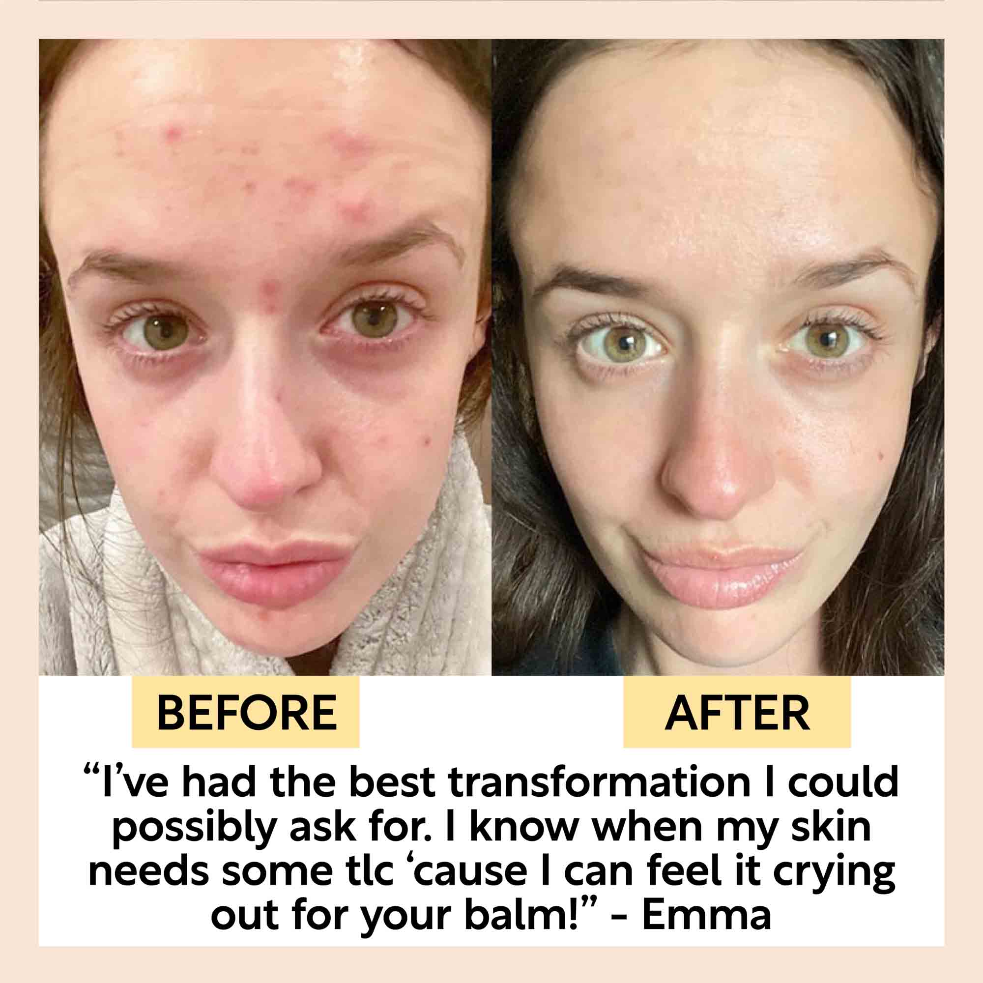 Cleansing Face Balm with Oat Oil + Vitamin E - Travel Size - Image 8
