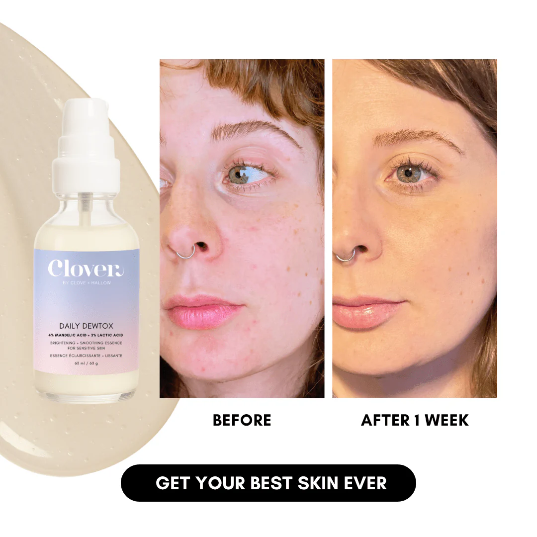 Daily Dewtox Smoothing & Brightening Essence - Image 3