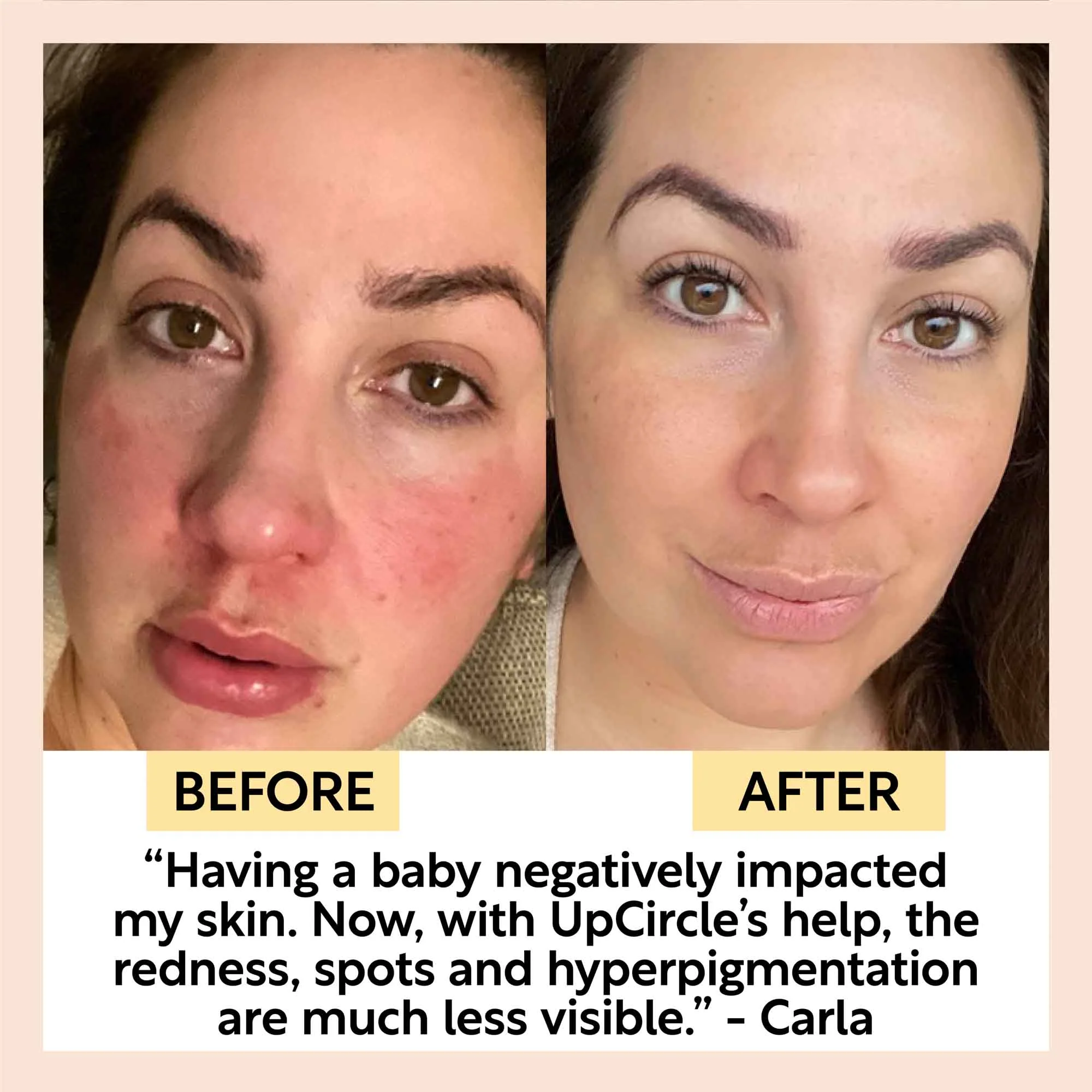 Day + Night Hydration Set - Image 9