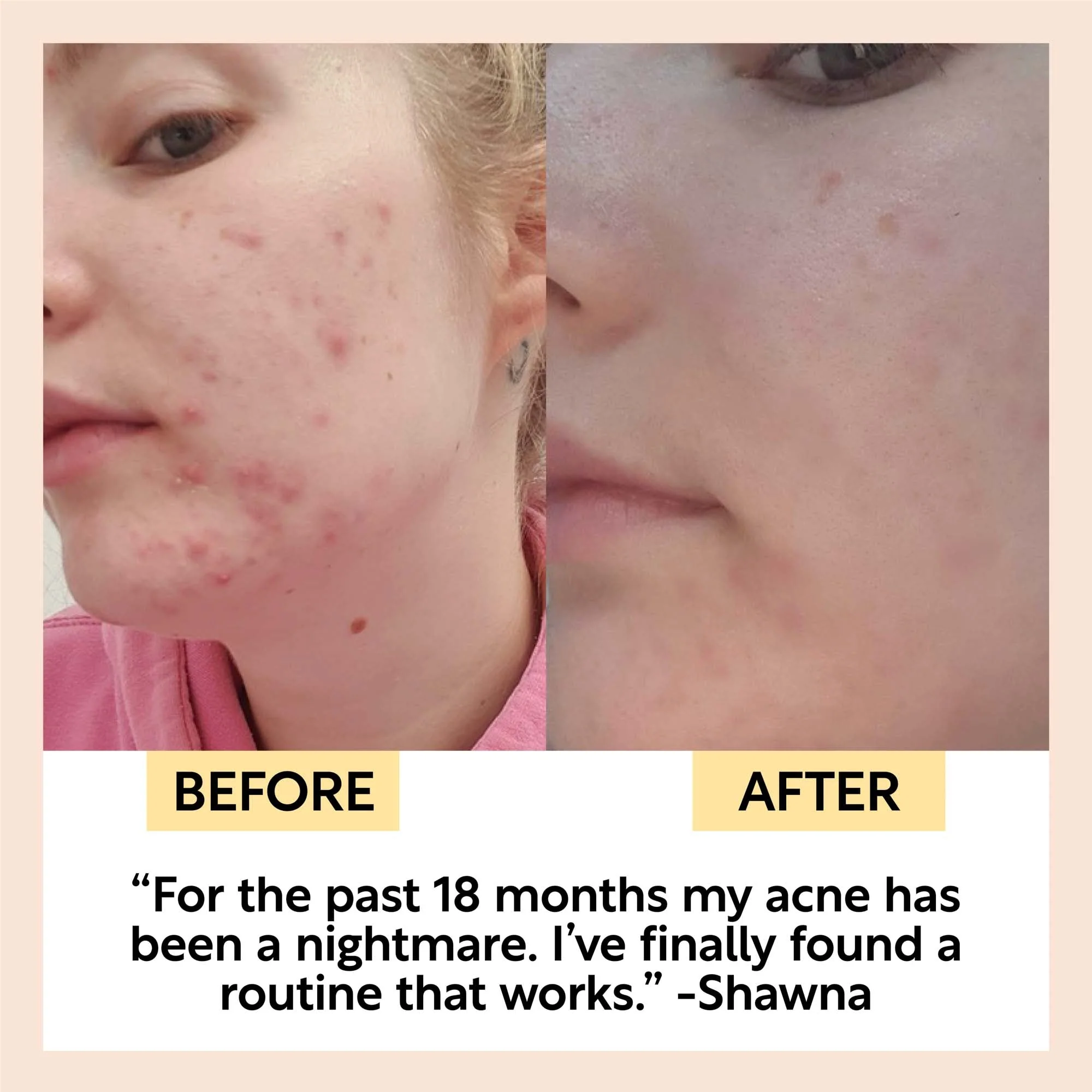 Double Cleansing Duo - Image 7