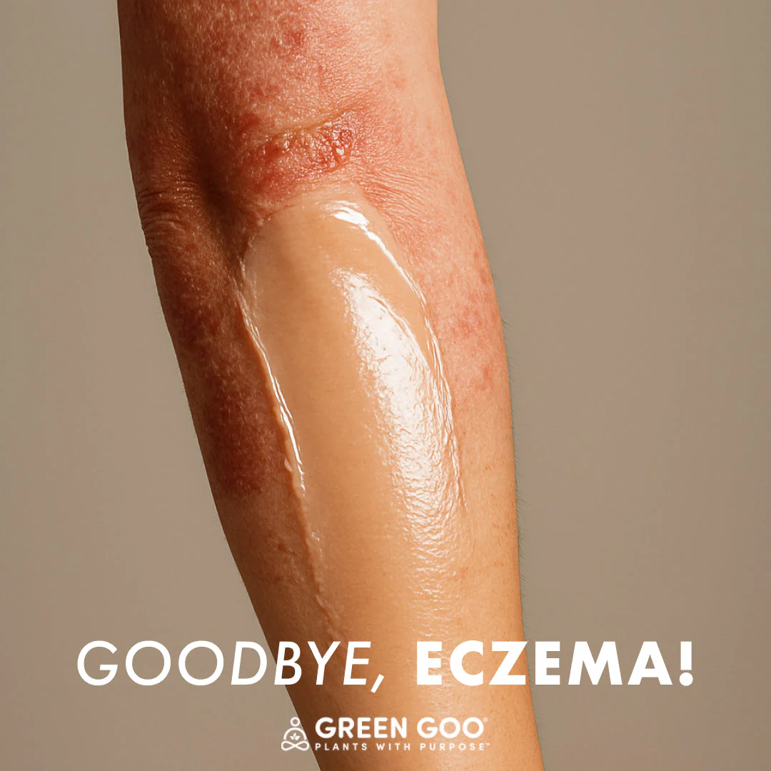 Dry Skin - Image 17