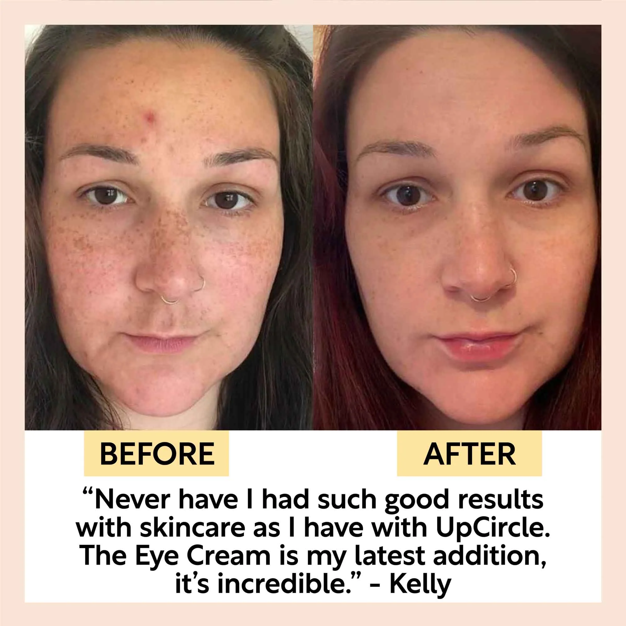 Eye Cream with Hyaluronic Acid & Coffee - Image 9