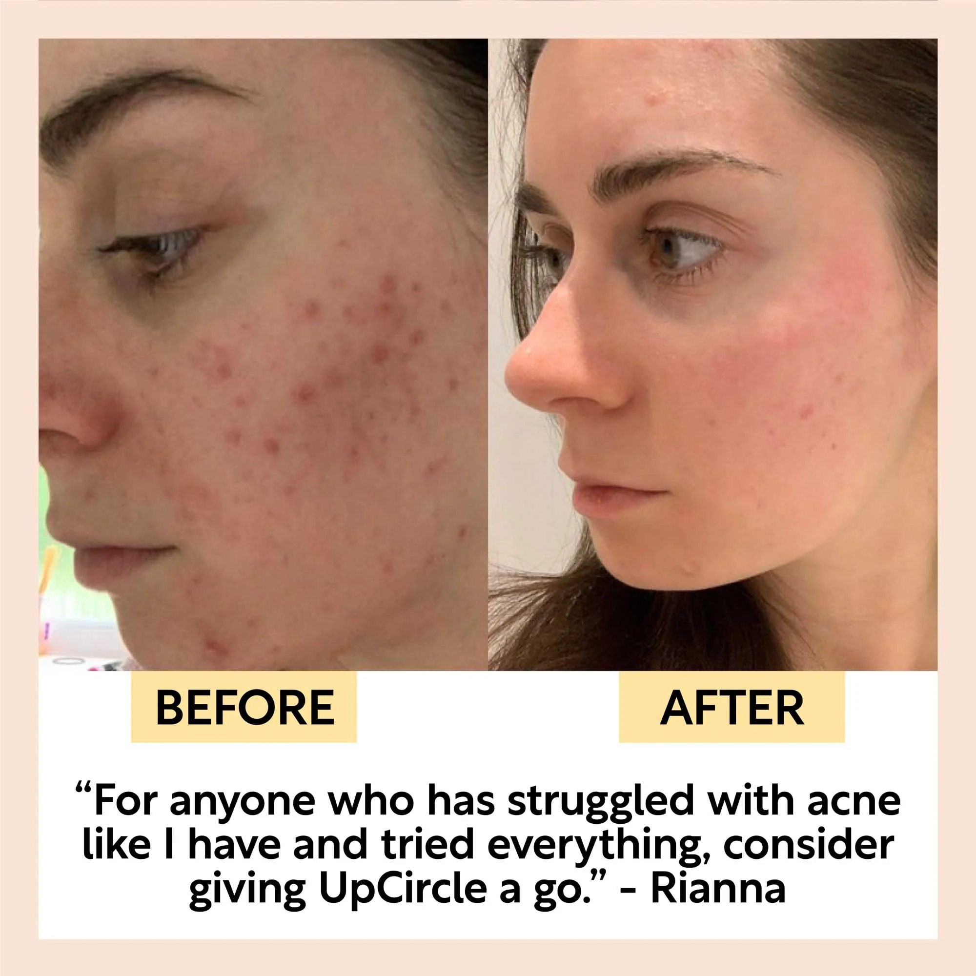 Face Toner with Hyaluronic Acid - Image 10