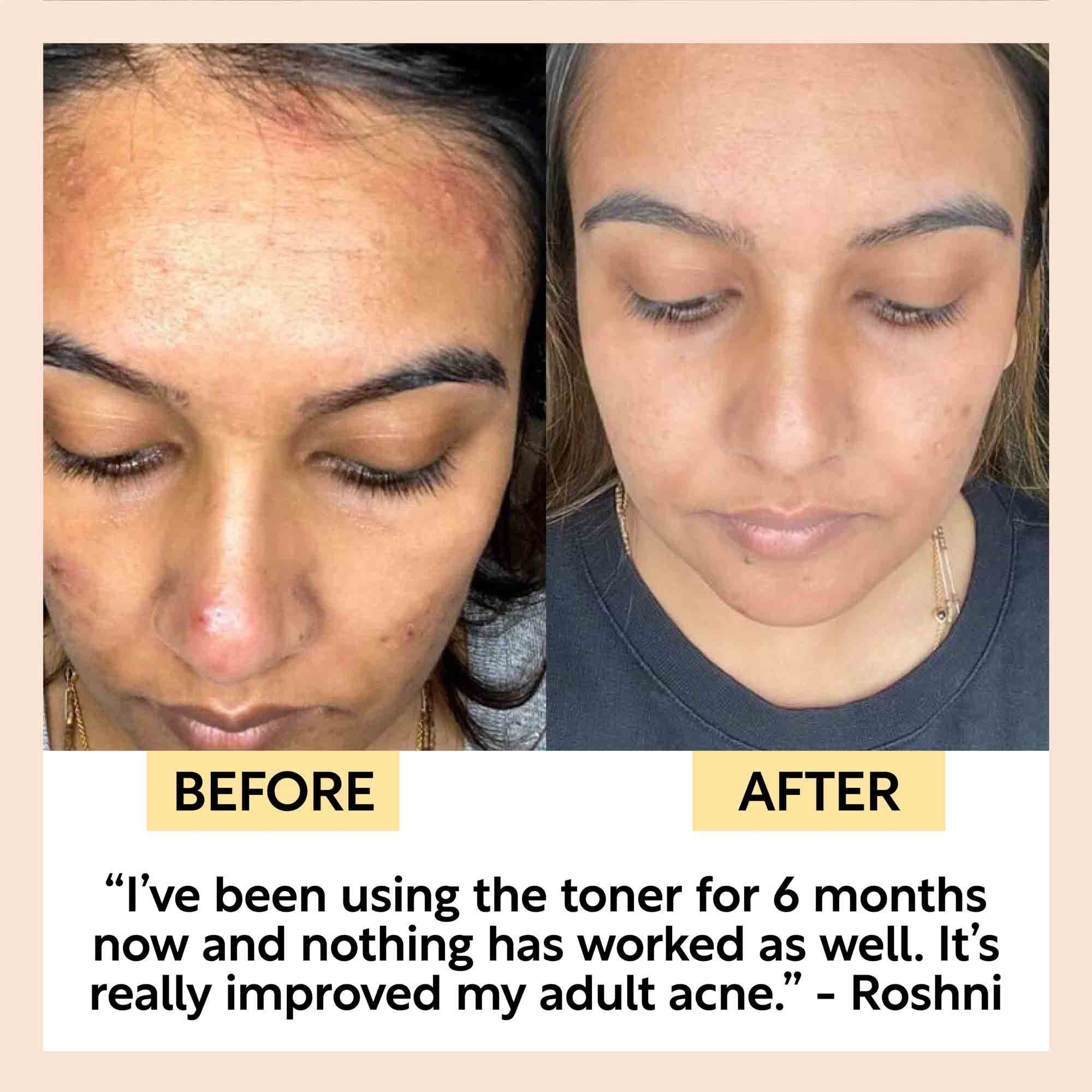 Face Toner with Hyaluronic Acid - Image 11