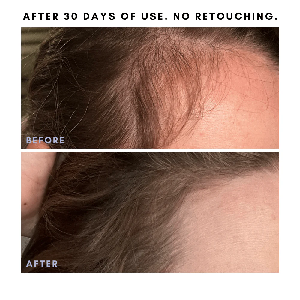 Full Of It Hair Growth Serum - Image 3