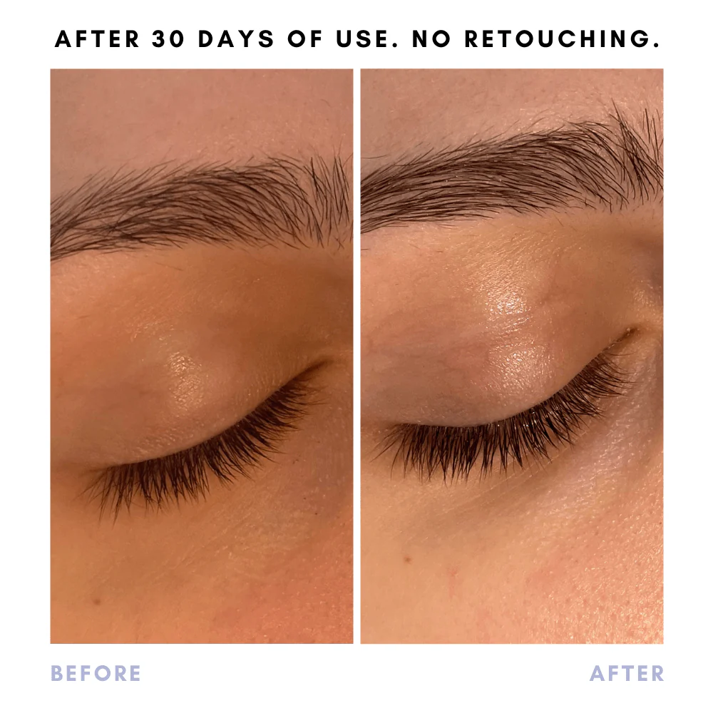 Full Of It Hair Growth Serum - Image 4