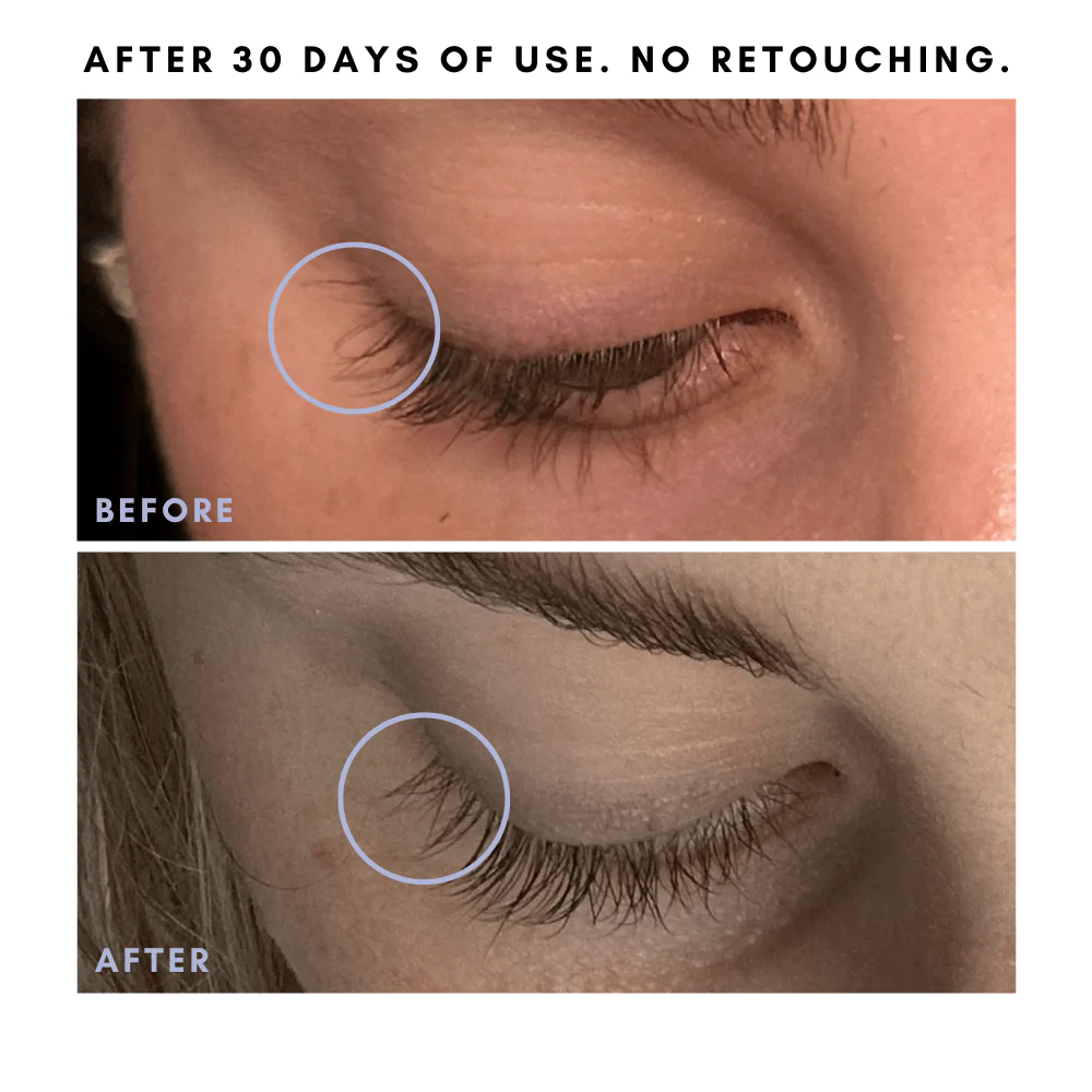 Full Of It Hair Growth Serum - Image 6