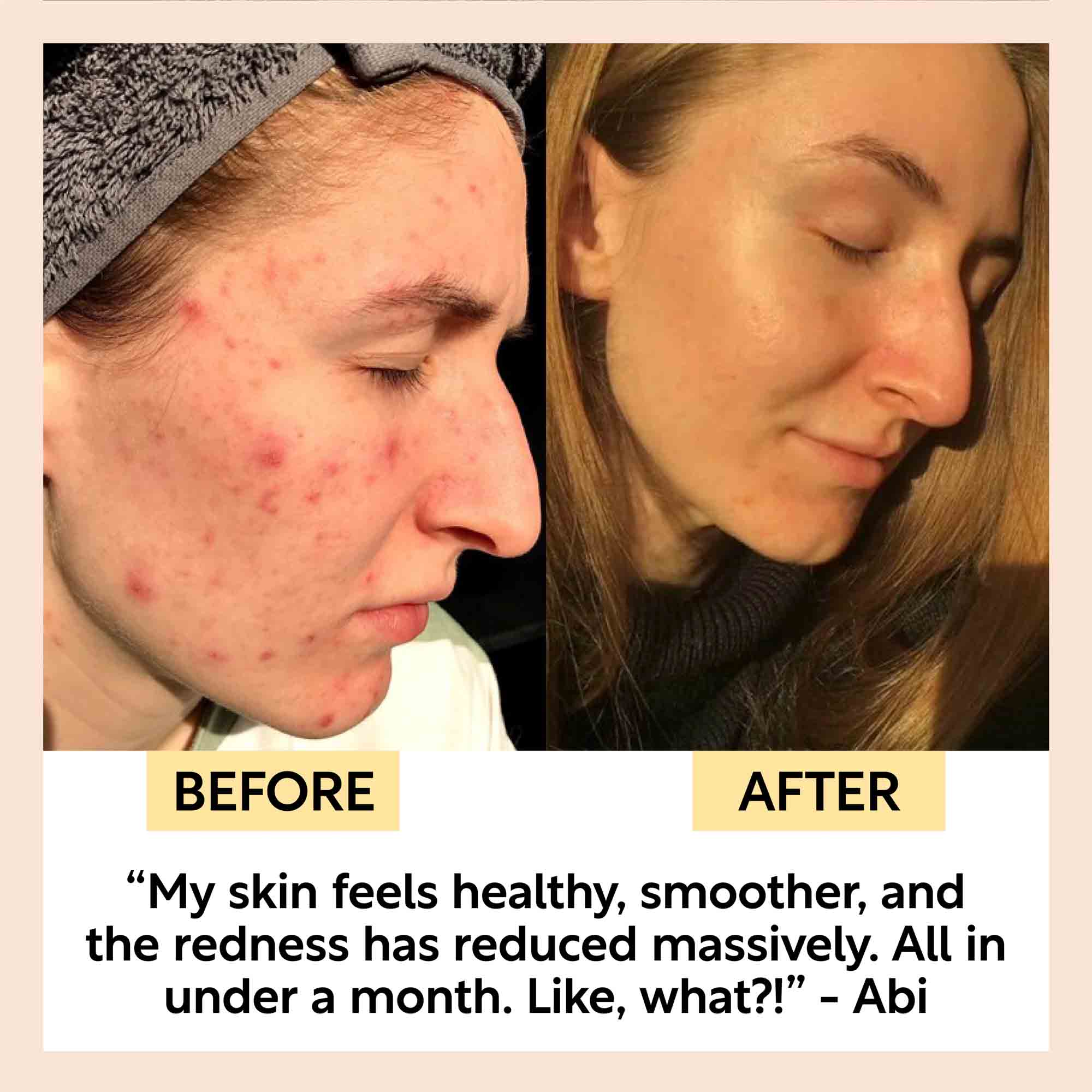 Kaolin Clay Face Mask - Image 3