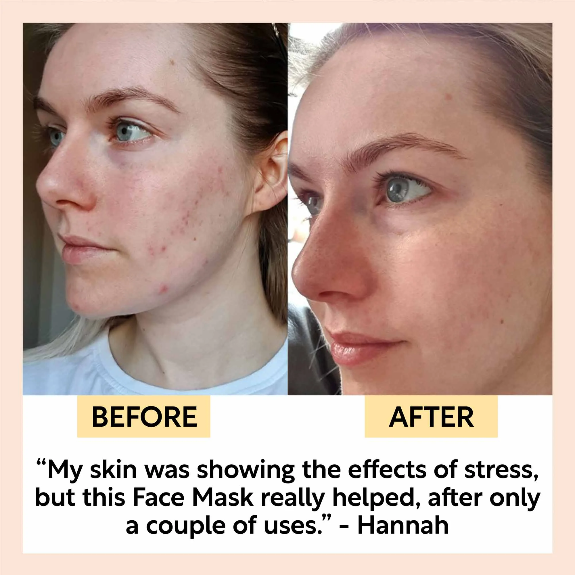 Kaolin Clay Face Mask - Image 5