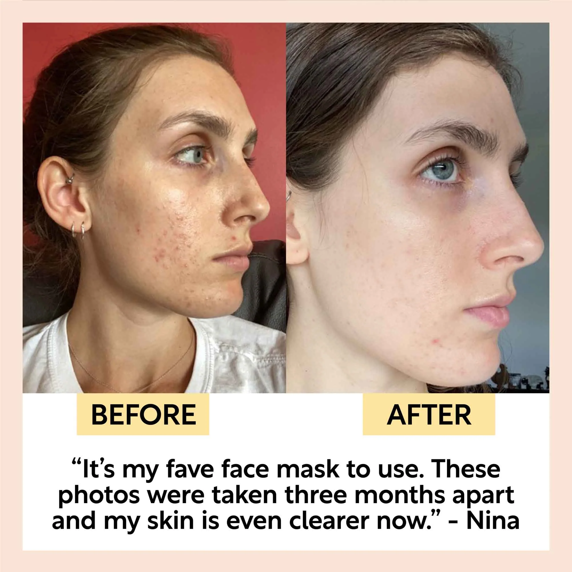 Kaolin Clay Face Mask - Image 8