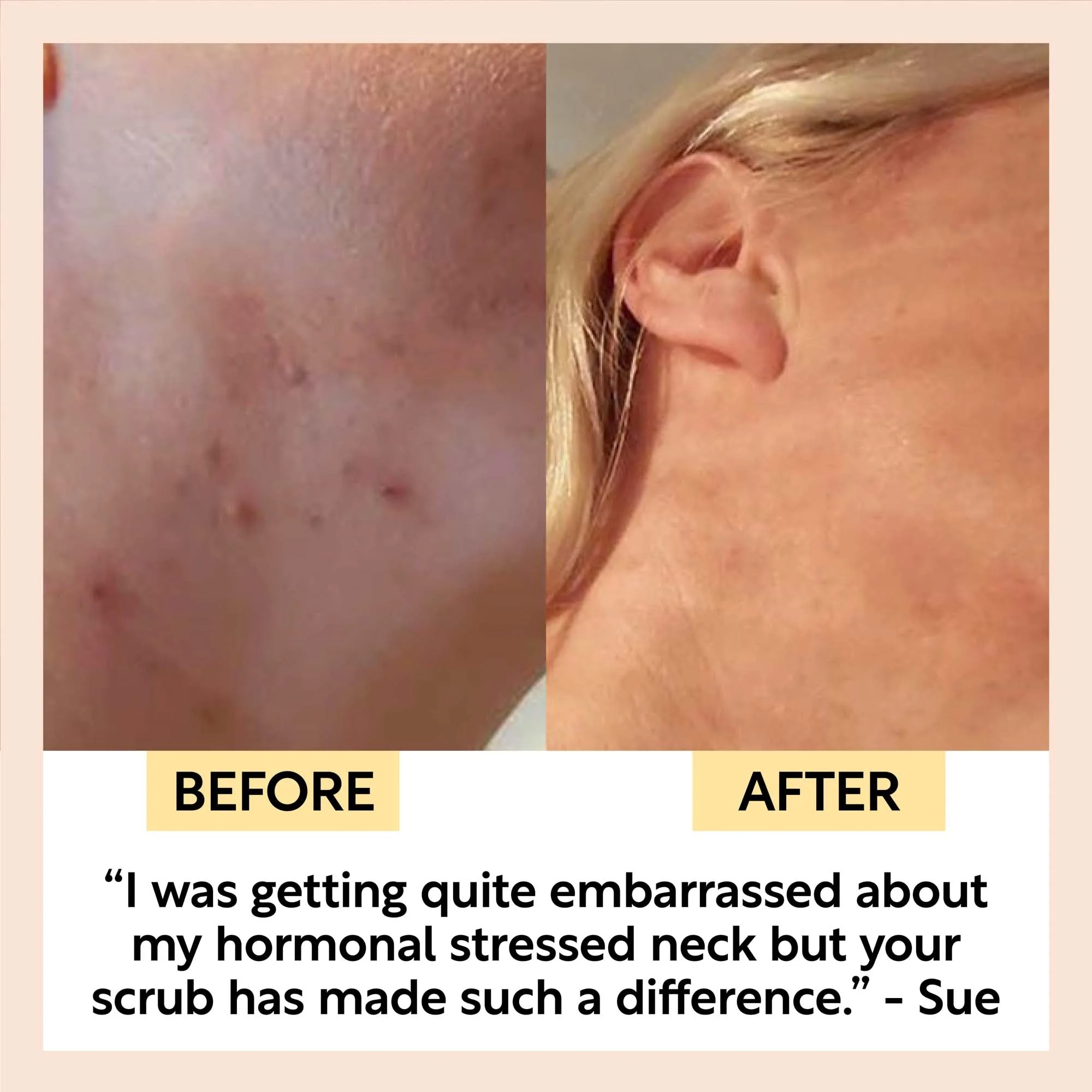 Natural Face Scrub – Citrus Blend for Dry Skin - Image 3
