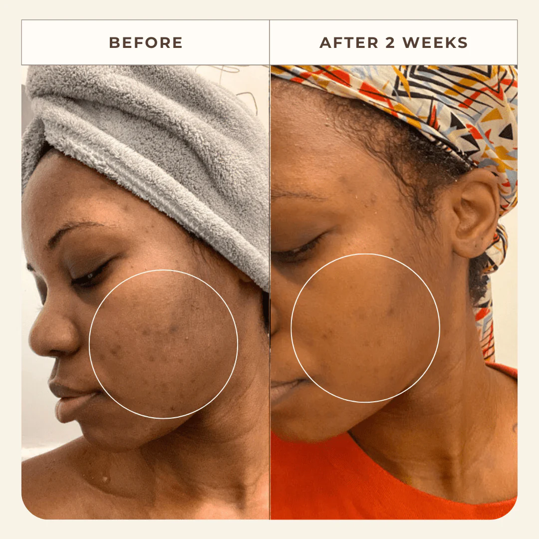 Neroli Clarifying Complexion Mist - Image 7