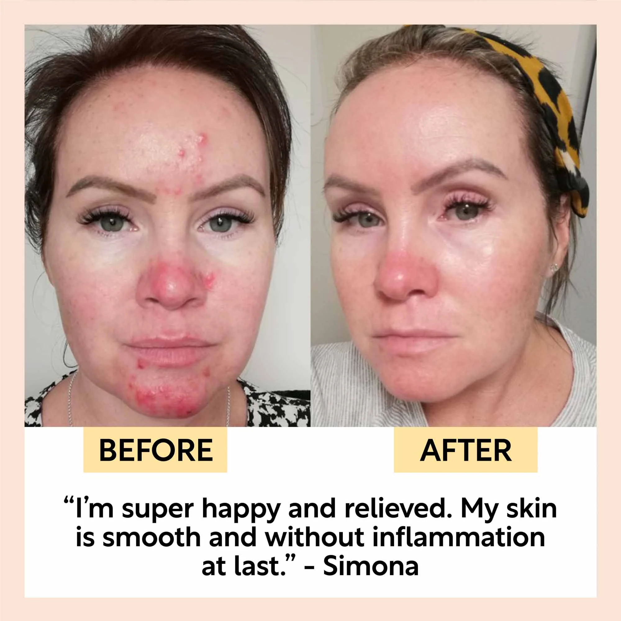 Night Cream with Hyaluronic Acid + Niacinamide - Image 9
