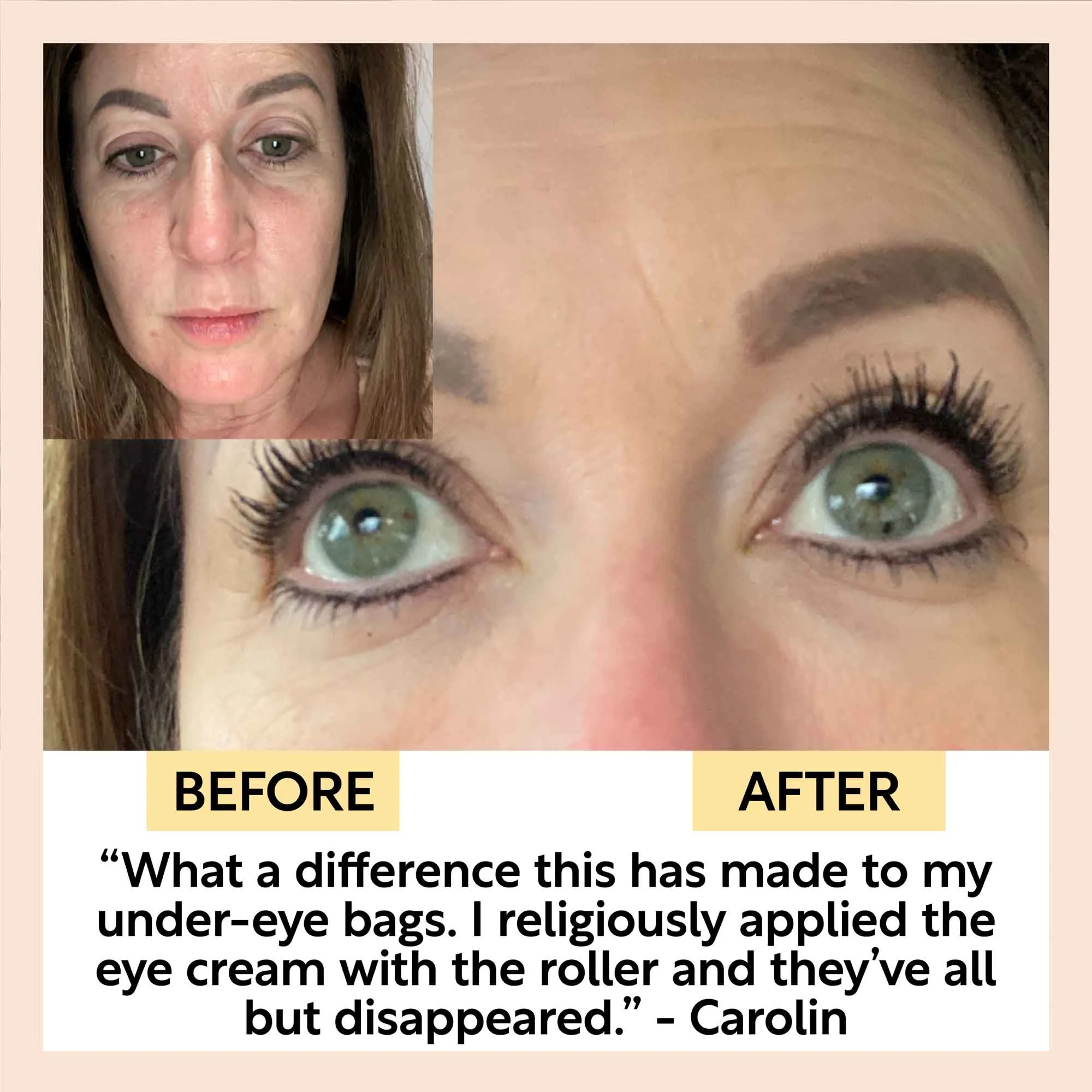 The Caffeinated Duo + Eye Roller Deal - Image 8