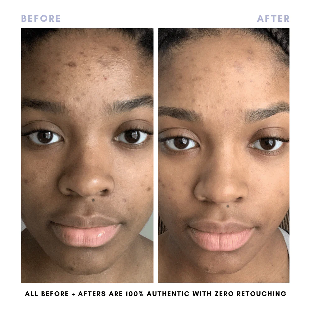 The Complete Skincare Collection - Image 13