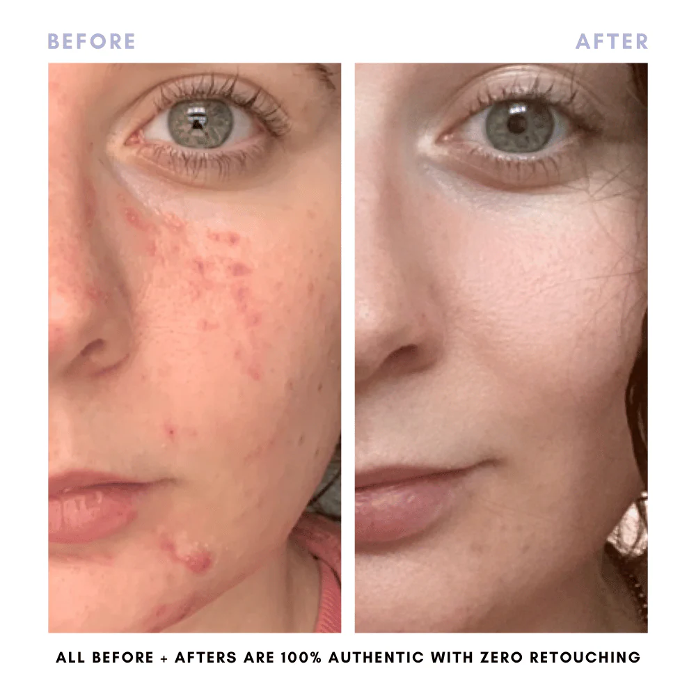 The Double Cleansing Duo - Image 6