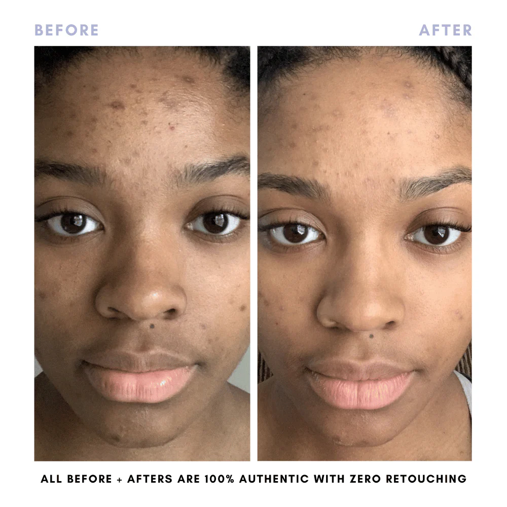 The Skin Reset Starter Kit - Image 13