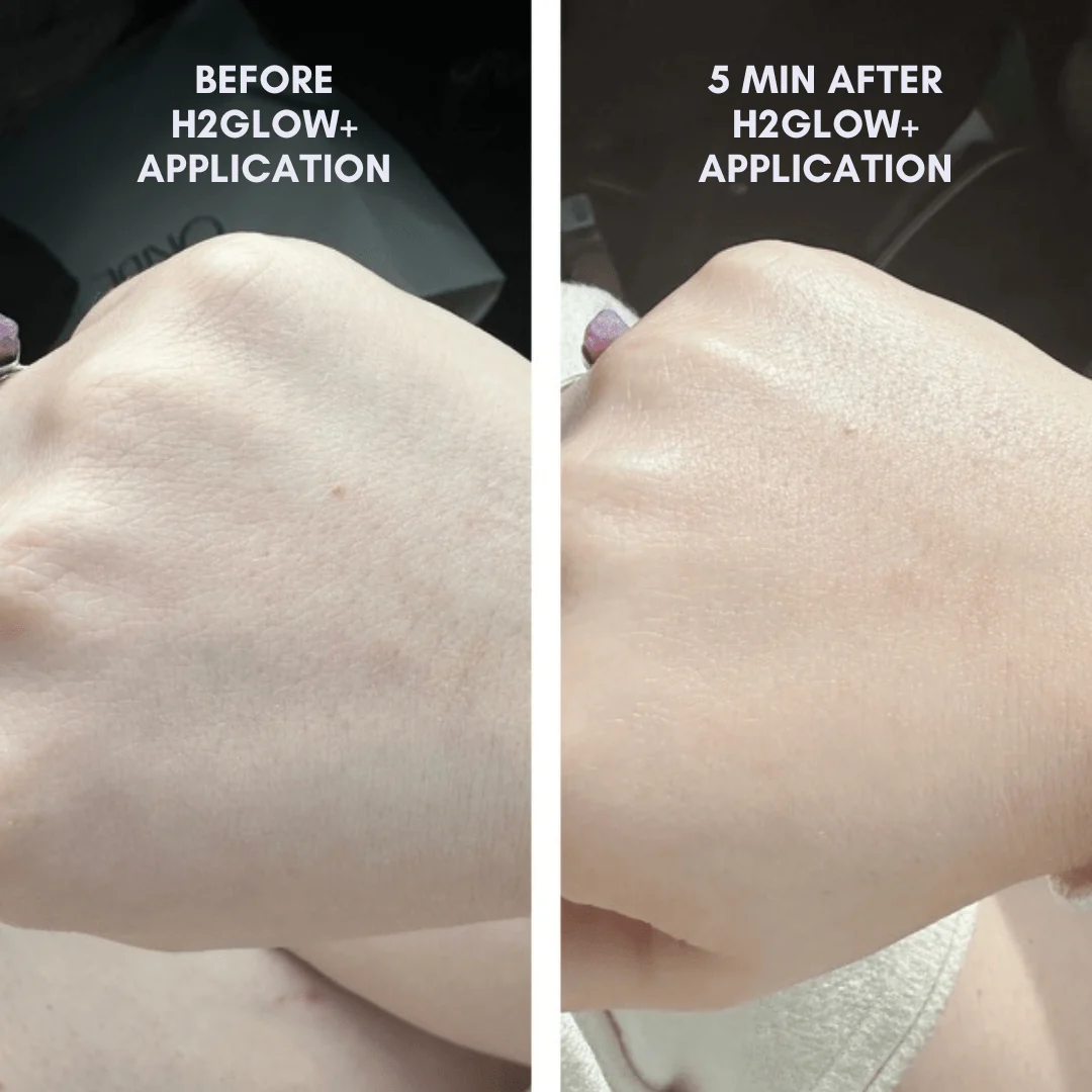 The Skin Reset Starter Kit - Image 4