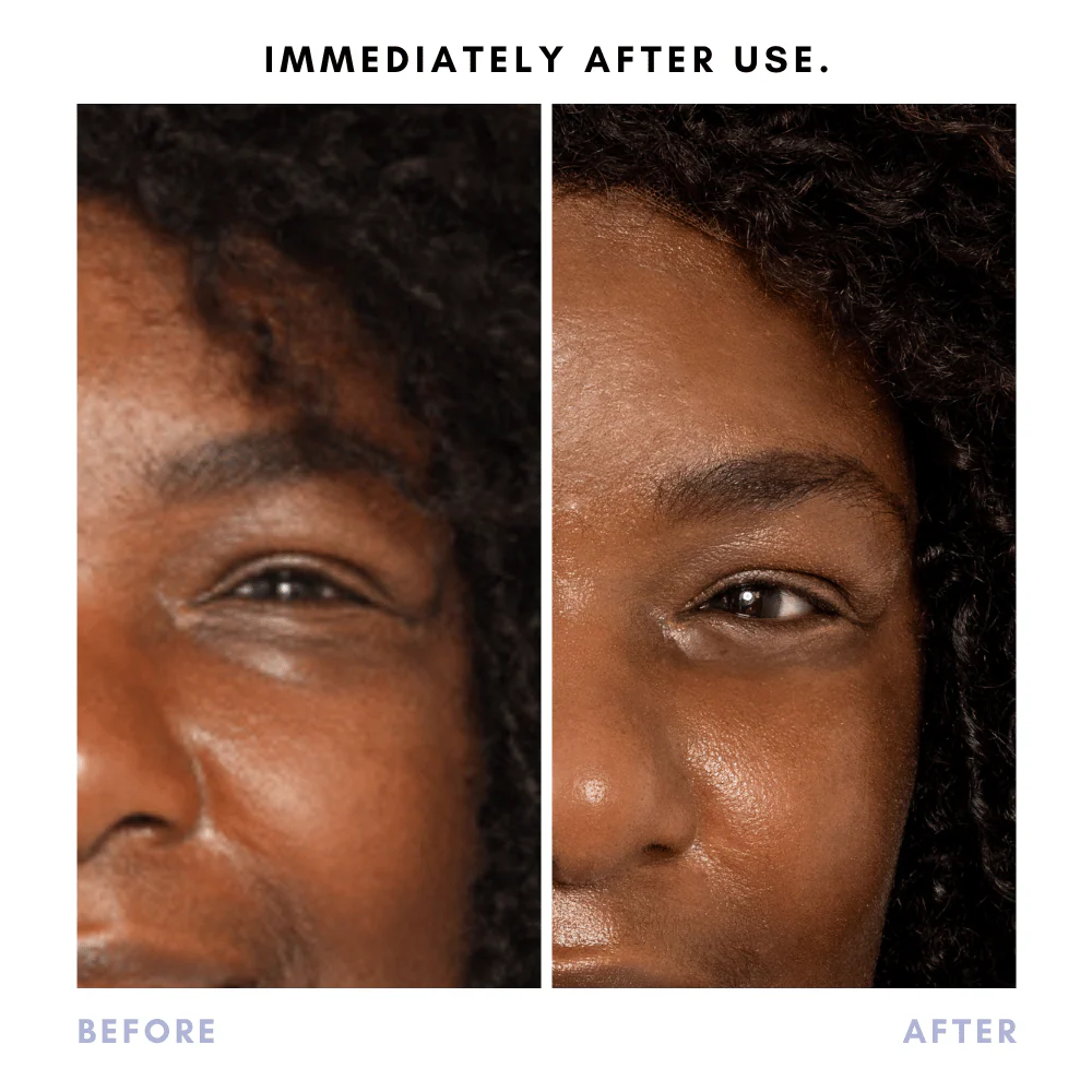 Triple Shot 3-in-1 Bioactive Eye Treatment - Image 8
