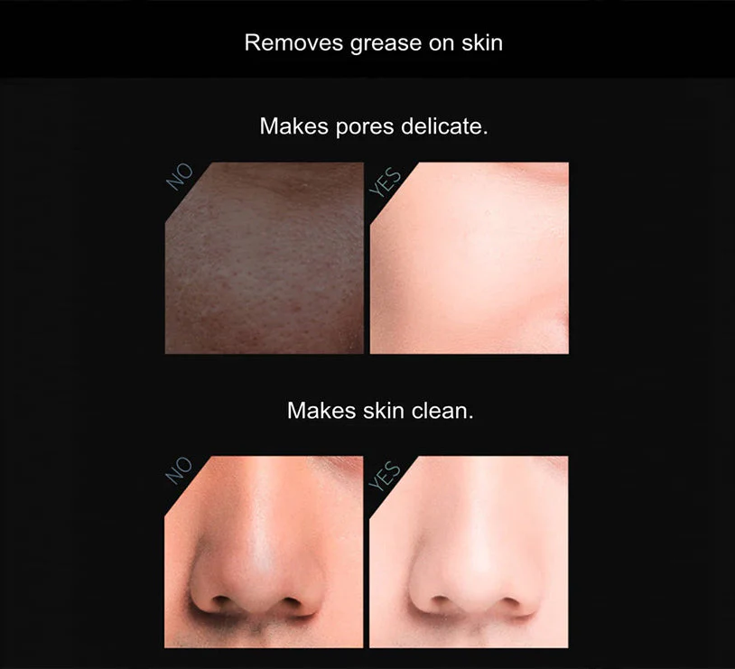 Volcanic Stone Oil-Absorbing Face Roller - Image 7